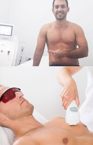 טיפול לייזר לגבר